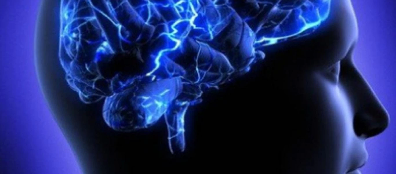 Εγκεφαλικό ανεύρυσμα: Τι ρόλο παίζει η ασπιρίνη; - Έρευνα απαντά